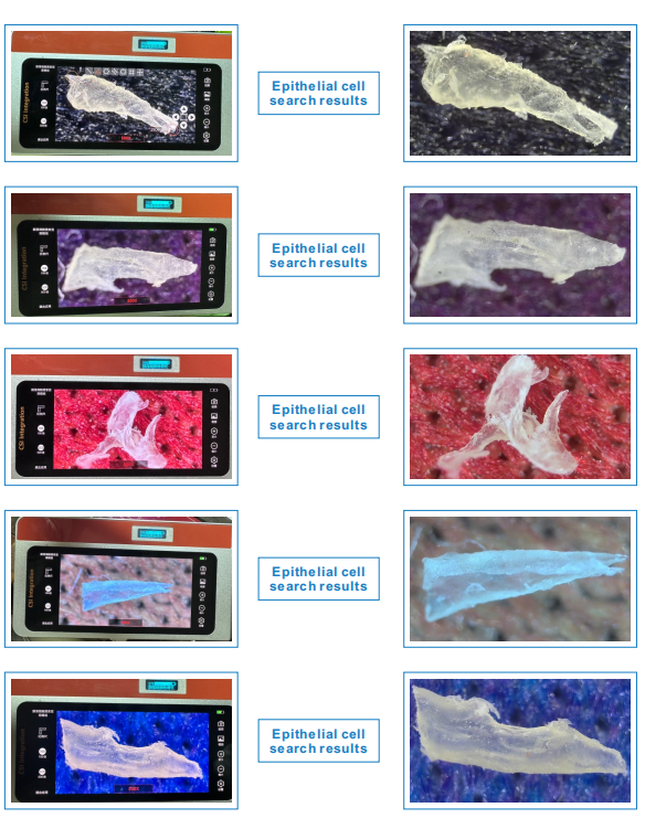 Epithelial Cells Intelligent System(图2)